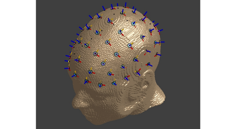 Sim4Life MR 影像 3D 建模與 10-10 系統電極自動放置操作步驟