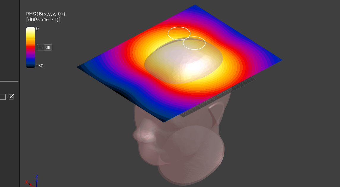 【教學錄影】以經顱磁刺激為例建立低頻磁場模擬流程  Developing a Low-Frequency Magnetic Field Simulation Workflow Using Transcranial Magnetic Stimulation (TMS)
