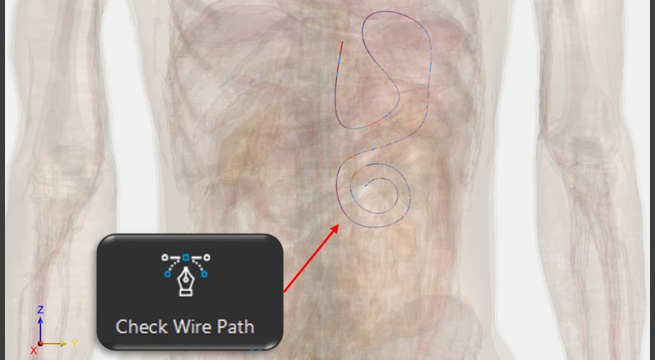植入物导线路径检查工具-Check Wire Path