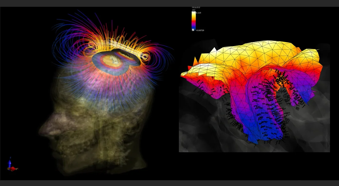【非侵入式腦刺激應用】從圖像數據到熱效應和神經刺激的模擬與分析