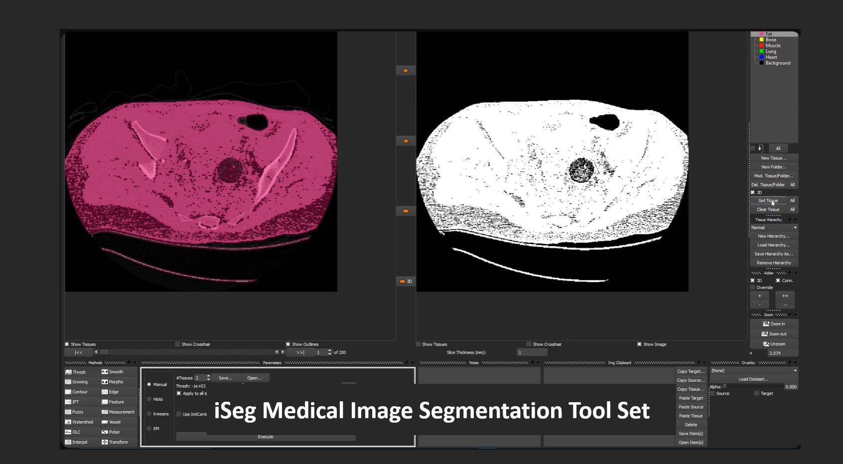 【医学图像处理】iSEG 医学图像分割和建模工具