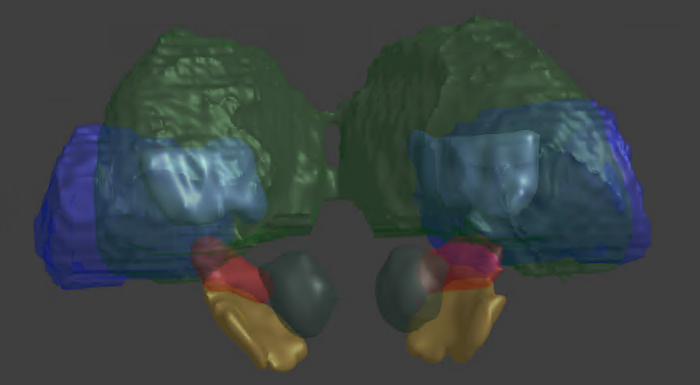 使用 iSeg 工具建立模型