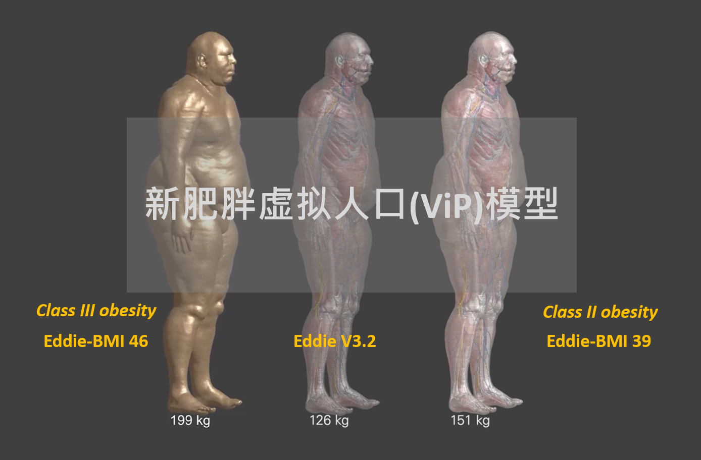 虚拟人口模型(ViP)扩充: 新增第二级与第三级肥胖模型